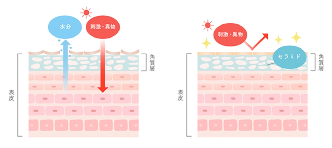 大切なのは肌のバリアを機能を守ること